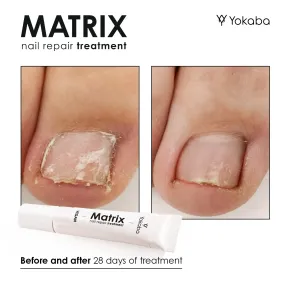 Yokaba Matrix Nail Repair - weganska odzywka do paznokci - AH Beauty