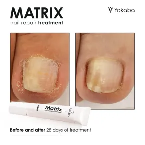 Yokaba Matrix Nail Repair - weganska odzywka do paznokci - AH Beauty